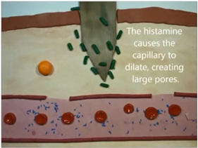 Inflammatory Process - 7 - Best Personal Trainer Abhinav Malhotra Dubai UAE
