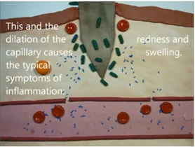 Inflammatory Process - 8 - Best Personal Trainer Abhinav Malhotra Dubai UAE